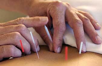 Acupuntura e Fisioterapia Blumer - Foto 1